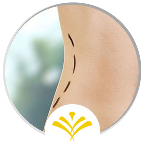CoolTone Treatment Specialist Near Me in Newington NH