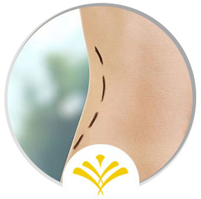 CoolTone Treatment Specialist Near Me in Newington NH