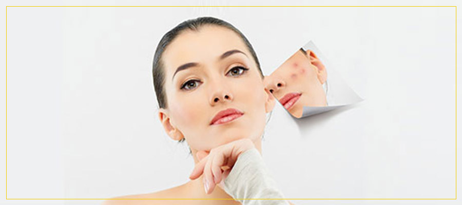 Acne Treatment Specialist Near Me in Newington NH