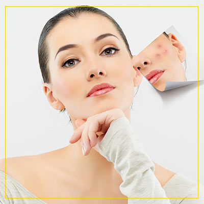 Acne Treatment Specialist Near Me in Newington NH