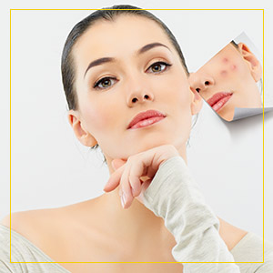 Acne Treatment Specialist Near Me in Newington NH