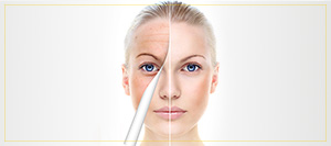 Chemical Peels Treatment Specialist Near Me in Newington NH