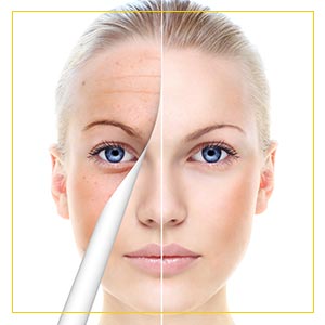 Chemical Peels Treatment Specialist Near Me in Newington NH