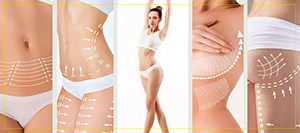Top CoolSculpting Treatment Specialist Near Me in New Hampshire Top CoolSculpting Treatment Specialist Near Me in New Hampshire