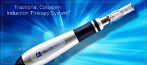 Rejuvapen Microneedling Treatment Specialist Near Portsmouth NH Rejuvapen Microneedling Treatment Specialist Near Portsmouth NH