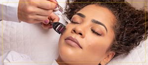 Benefits of RF Microneedling Treatment Near Me in Newington, NH Benefits of RF Microneedling Treatment Near Me in Newington, NH