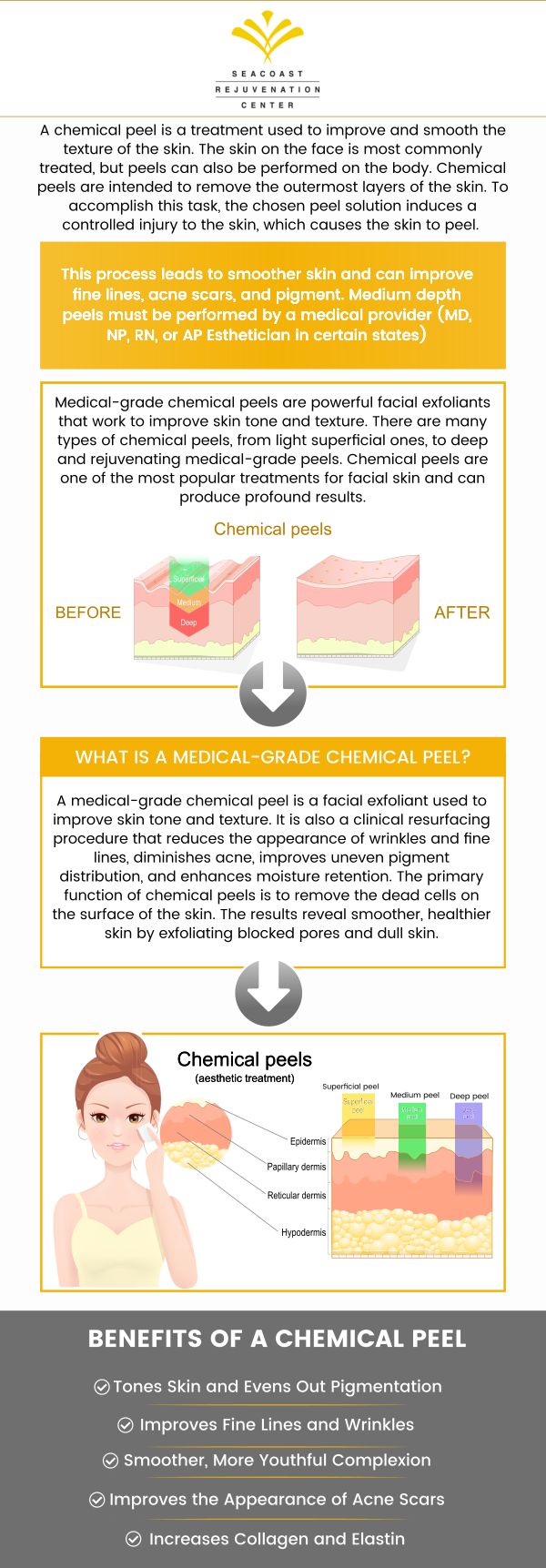 If you want to enhance and smooth your skin without surgical intervention, a chemical peel may be the right treatment for you! Visit Seacoast Rejuvenation Center today to learn the benefits of chemical peels. Contact us today or book an appointment online. Our med spa is conveniently located at 101 Shattuck Way Suite #1 Newington, NH 03801.