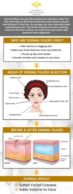 Dermal fillers are soft gel-like substances that work by creating skin replacements that may have been lost due to the appearance of wrinkles. Dermal Filler injections take only a few minutes and they make a big difference. Visit Seacoast Rejuvenation Center for more information. Contact us today or schedule an appointment online. Our med spa is conveniently located at 101 Shattuck Way Suite #1 Newington, NH 03801.