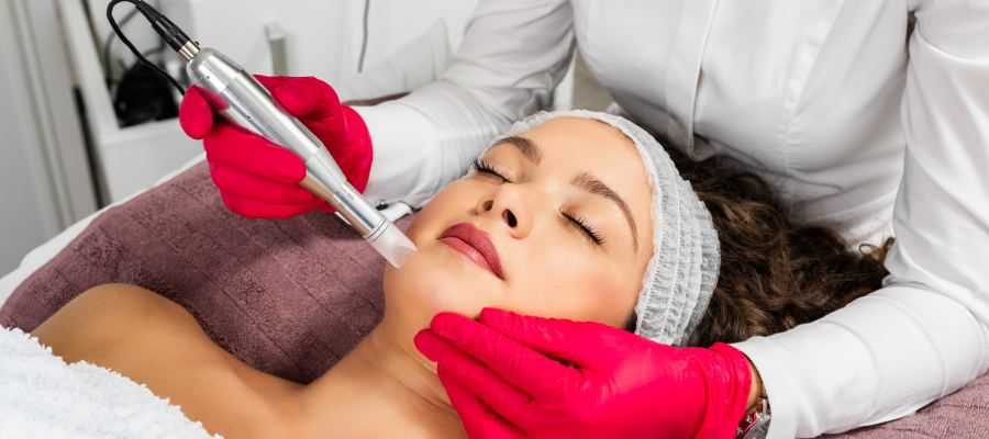 Does Microneedling Help with Acne Scars? | Seacoast Rejuvenation Center in Newington, NH